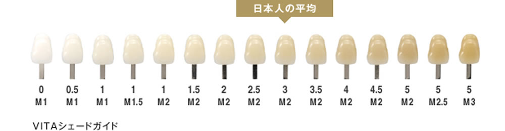 歯のホワイトニングをご検討中の方